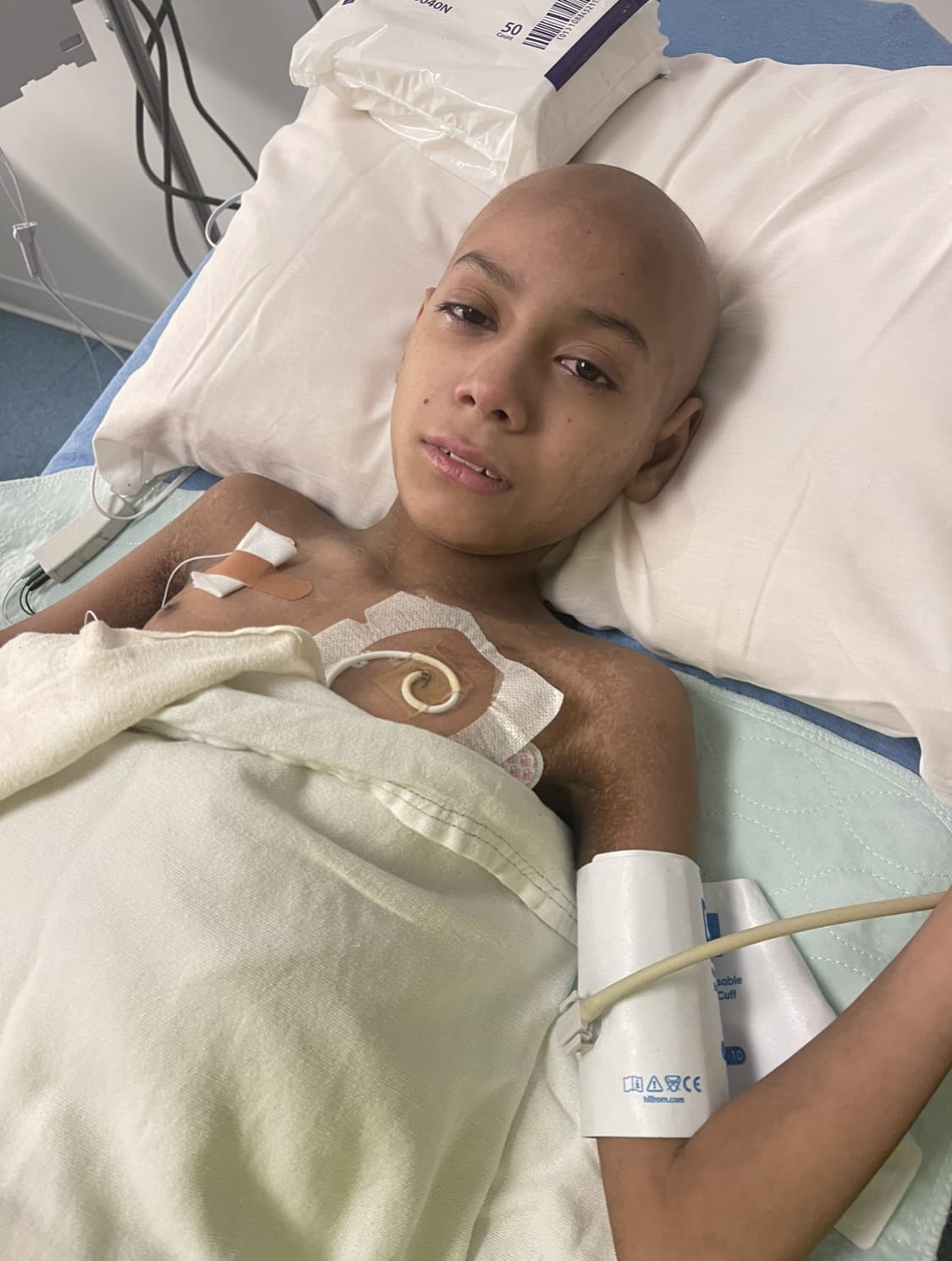 Ricky during GVHD treatment